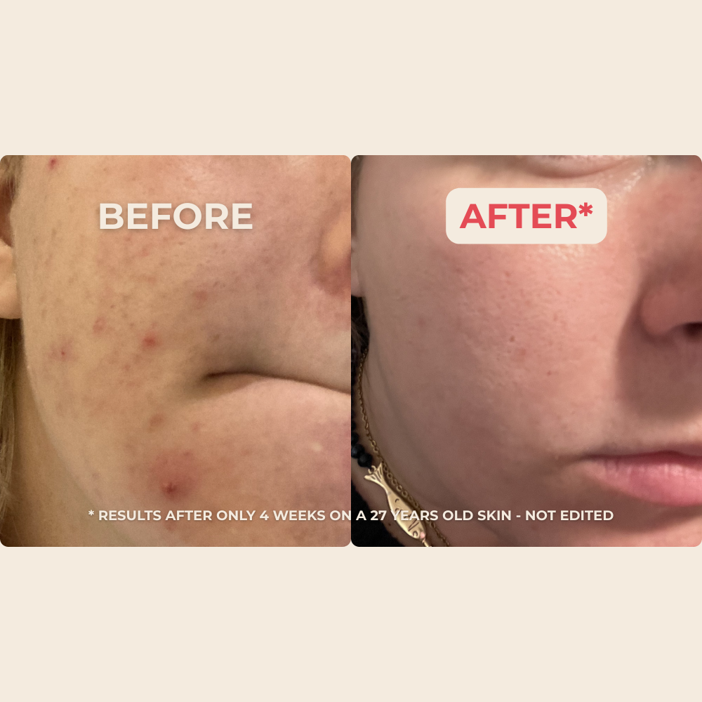 Skin Revival Trio Miracle Skincare